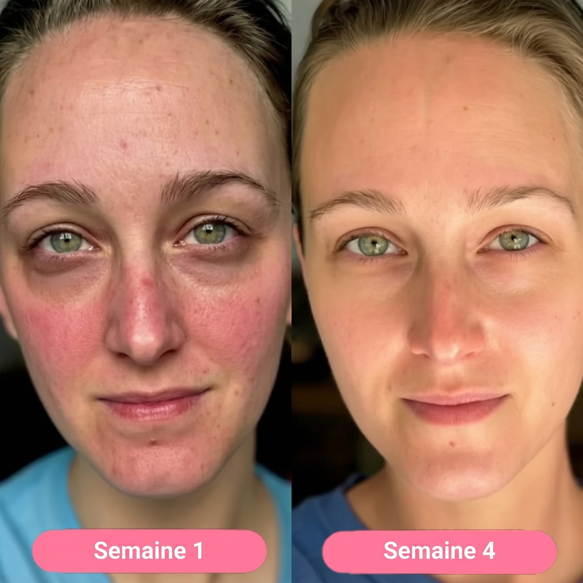 Settimana 1 / settimana 4