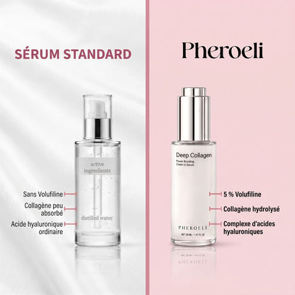 Siero standard vs Pheroeli