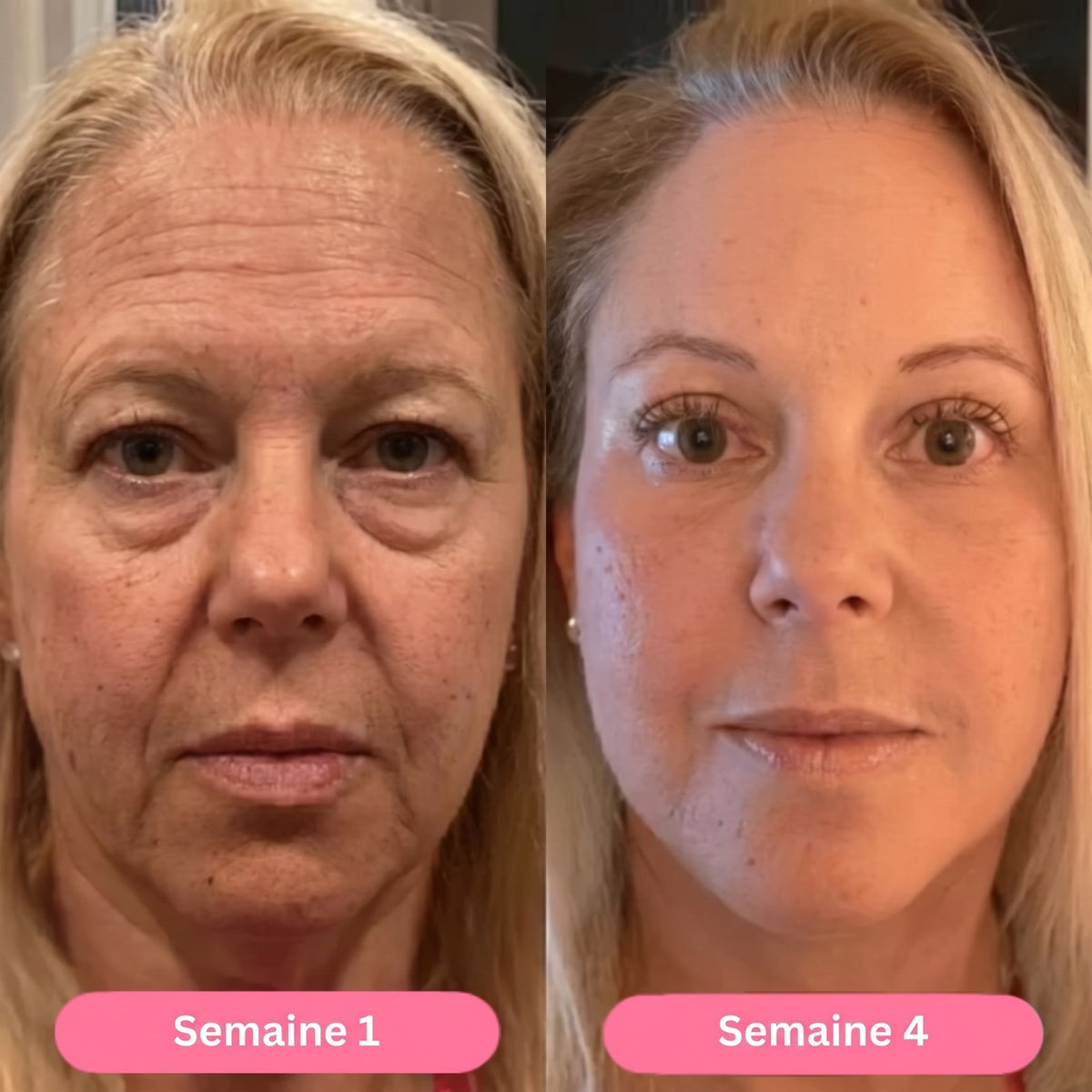 Settimana 1 / settimana 4