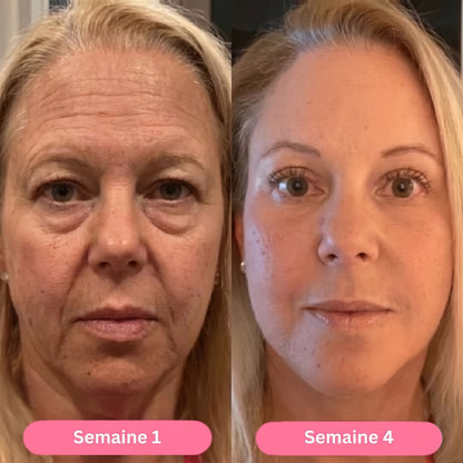 Settimana 1 / settimana 4